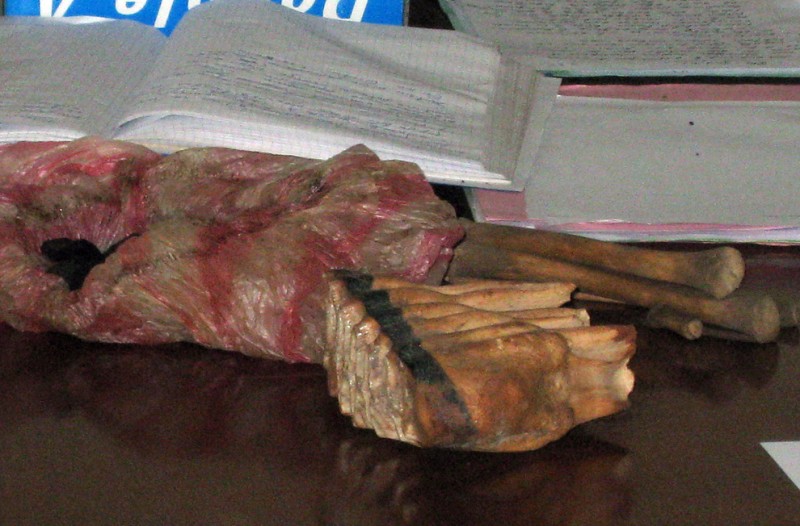 8) На этом снимке, сделанном 28 мая 2009 года, можно видеть части человеческого тела, включая бедренную кость, и содранную кожу, которые выставлены в зале суда во время судебного процесса над 11 бурундийцами. Подсудимые обвиняются в убийстве альбиносов, чьи конечности были проданы знахарям из соседней Танзании, в Руйиги. В ходе судебного разбирательства бурундийский прокурор, Никодеме Гахимбаре потребовал для подсудимых от одного года до пожизненного заключения. Гахимбаре требовал пожизненного заключения в качестве наказания для трех из 11 обвиняемых, восемь из которых были на скамье подсудимых за убийство восьмилетней девочки и мужчины, которое было совершено в марте этого года. (Esdras Ndikumana/AFP/Getty Images)