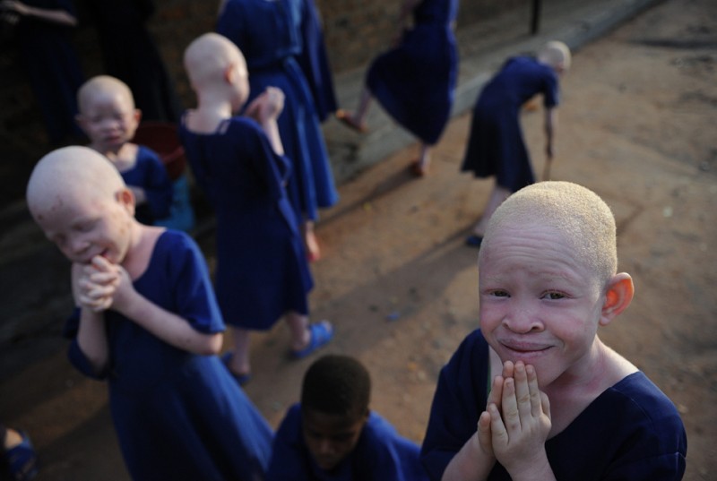 6) Дети-альбиносы во время перемены в рекреации начальной школы для слепых Митидо 25 января 2009 года. Эта школа стала настоящим убежищем для редких детей-альбиносов. (TONY KARUMBA/AFP/Getty Images)