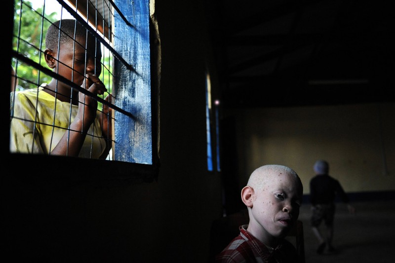 3) Девятилетний Амани сидит в рекреации начальной школы для слепых в Митидо 25 января 2009. Он поступил сюда после, убийства его сестры, пятилетней Мариам Эммануэль, девочки-альбиноски, которая была убита и расчленена в феврале 2008 года. (TONY KARUMBA/AFP/Getty Images)