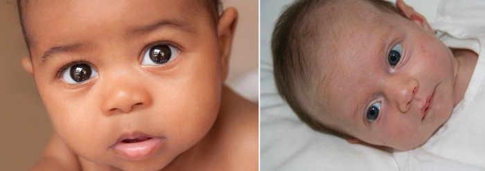 Чаще всего глаза меняются в возрасте до двух лет, причем именно темнеют.
